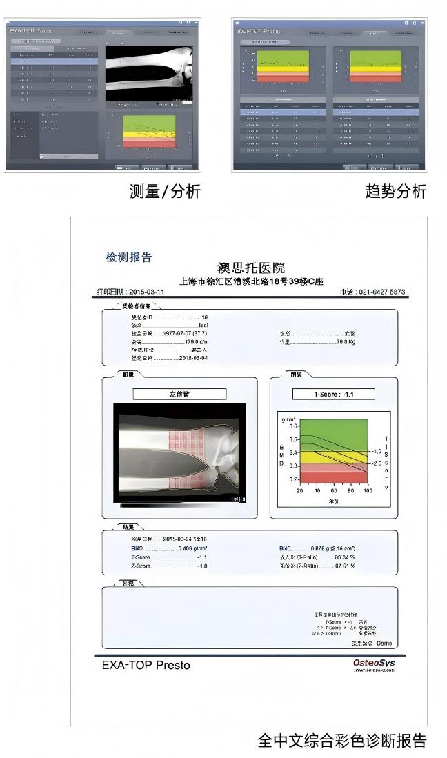 EXA-TOP Presto彩頁2023-國產(chǎn)_02(1).jpg